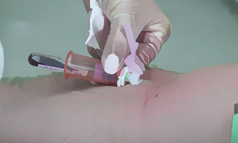 IST et Dépistage Tout savoir pour ta santé