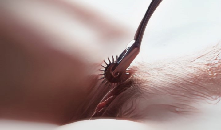 Roulette de Wartenberg